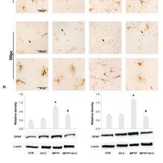 Gfap Analysis A Gfap Immunoreactive Astrocytes In The Striatum