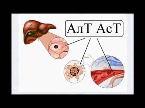 Элэгний маркерууд буюу АЛАТ АСАТ гэж юу вэ? - YouTube