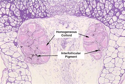 Medium 10x Magnification Photomicrographs Of Thyroid Glands From X