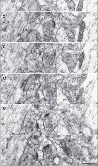 Learning Induced Synaptogenesis and Structural Synaptic Remodeling ...