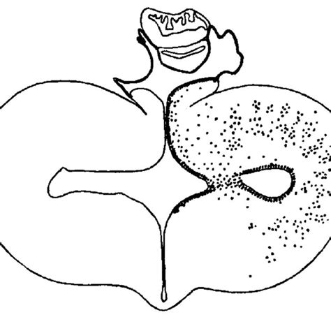 Coronal section through the hemisphere of Petromyzon Planeri ...