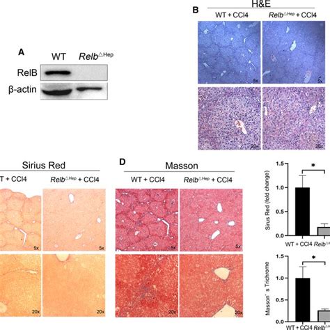 Hepatocytespecific Relb Knockout Inhibits Progression Of Liver