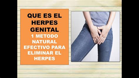 Cura Para El Herpes Genital 2024 Tim Layney