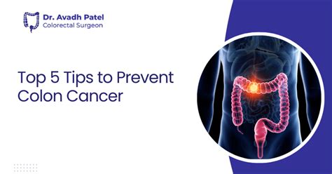 Top 5 Tips To Prevent Colon Cancer Dr Avadh Patel