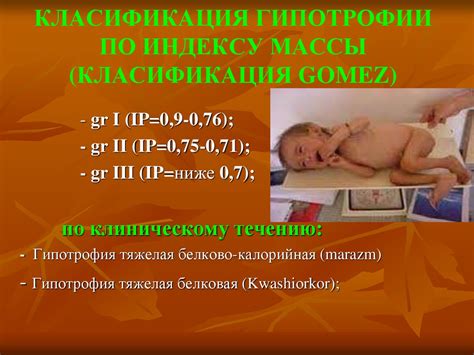 Гипотрофии у детей - презентация онлайн