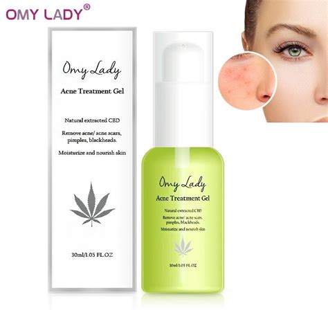 Acne Treatment Serum Omy Lady Beauty And Personal Care Face Face Care