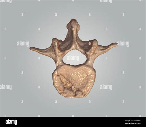 Ct Lumbar Or L S Spine D Rendering Image On Gray Background Top View