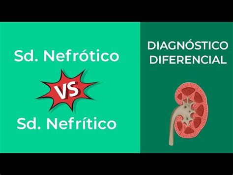 S Ndrome Nefr Tico Vs Nefr Tico Diferencias Y Caracter Sticas