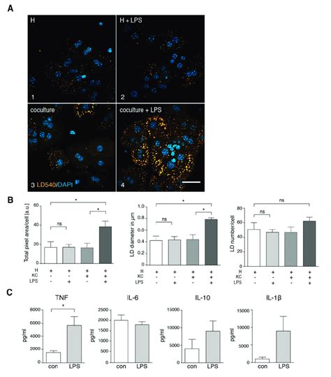 Intracellular Lipid Droplet Accumulation In Hepatocytes Upon In Vitro