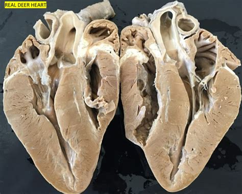 deer heart diagram quizlet