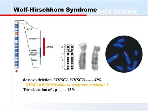 PPT - 염색체질환 Chromosome Disorders PowerPoint Presentation, free download ...