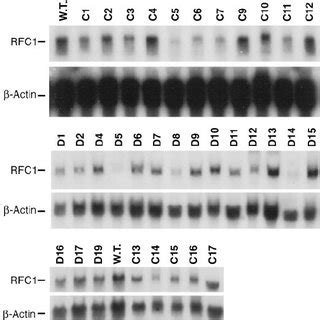 Autoradiogram Of Northern Blot Analysis Of Total Rna Isolated From