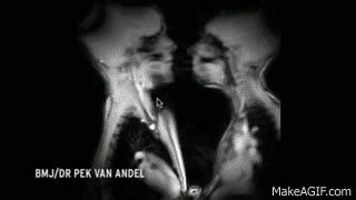 Amazing MRI Scan Video Captures Couple Having Sex 2014 On Make A
