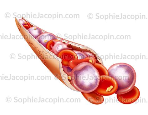 Cellule De Moelle Osseuse Archives Illustration Medicale