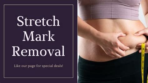 Stretch Marks Symptoms Causes Risk Factors Treatments In 2020