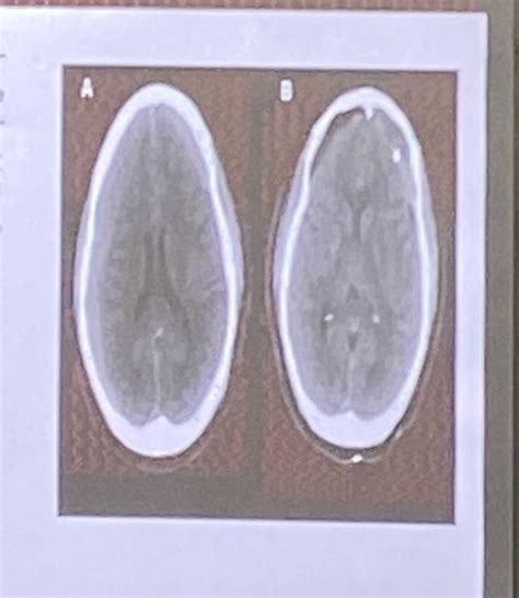 Solved Mrs M Aged Presented At The Emergency Chegg