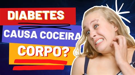 Diabetes Causa Coceira No Corpo Youtube