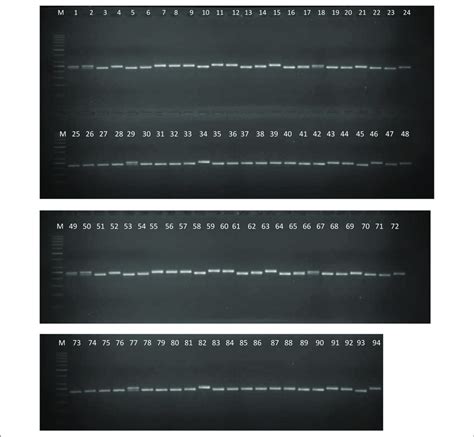 A Representative Gel Image Showing SSR Profiles Of 94 Pigeonpea