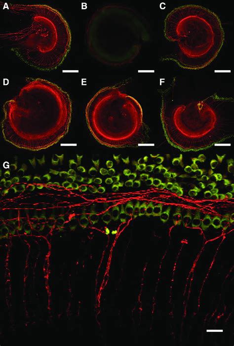 Confocal Microscopy With Staining For Spiral Ganglion Neurons Red And