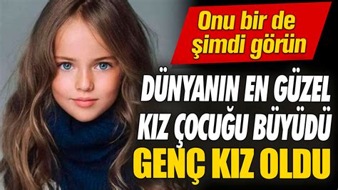 D Nyan N En G Zel K Z Ocu U B Y D Gen K Z Oldu Onu Bir De Imdi G R N