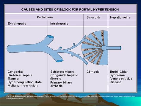 Portal Hypertension12