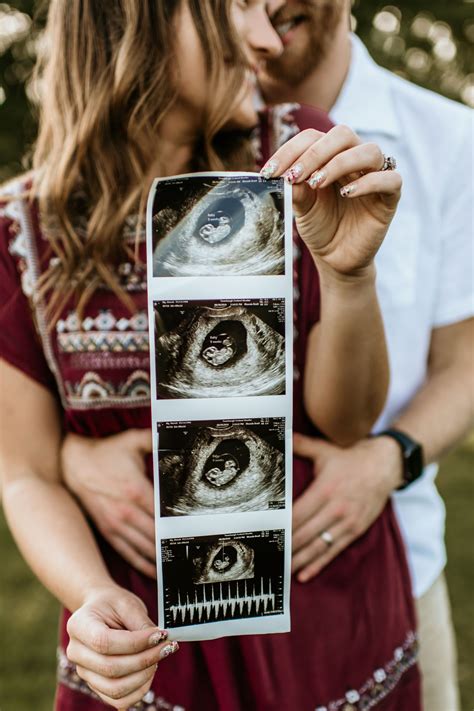 What To Expect At Your 8 Week Ultrasound Appointment Artofit