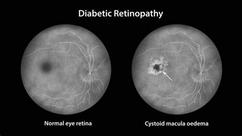 Ophthalmoscope Free Stock Photos Images And Pictures Of Ophthalmoscope