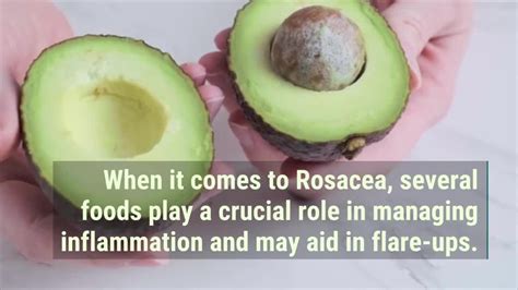 The Best And Worst Foods For Rosacea