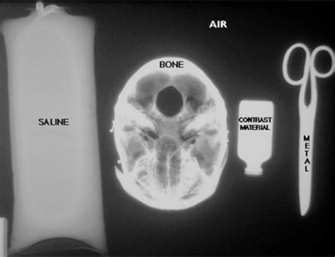 Medi Radiographs Flashcards Quizlet