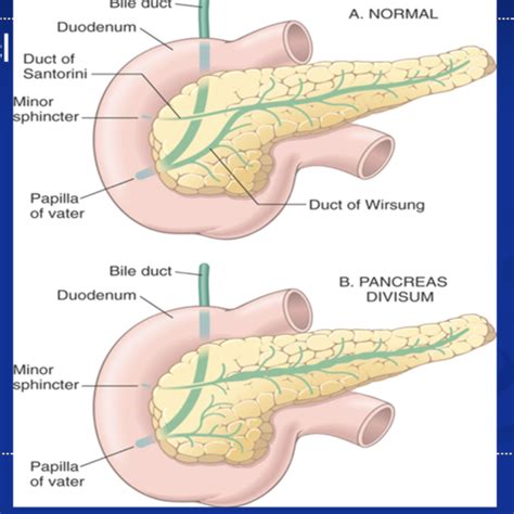 Pancreas Flashcards Quizlet