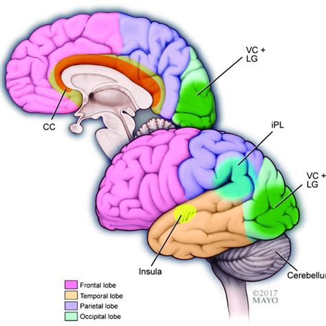 (PDF) Brain functional connectivity in headache disorders: A narrative review of MRI investigations