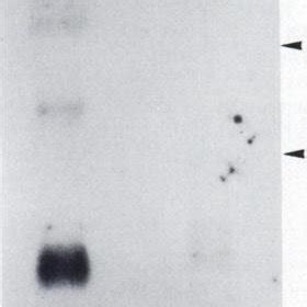 Northern Blot Analysis Of Gst T Mrna About Pg Of Total Rnas