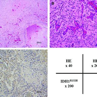 Photomicrographs Magnification Or Of The Current Case He