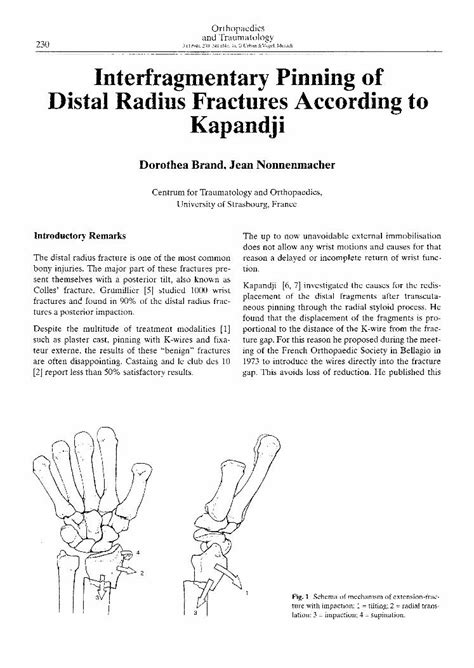 Distal Radius Fracture Kapandji Intrafocal Pinning Technique