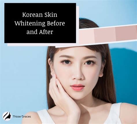 Korean Skin Whitening Before and After (With Videos) - ThoseGraces.com