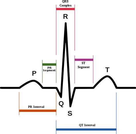 Med Surg Ekg And Cardiac Dysrhythmias Diagram Quizlet