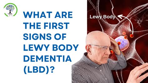 What Are The First Signs Of Lewy Body Dementia Lbd Voise Foundation