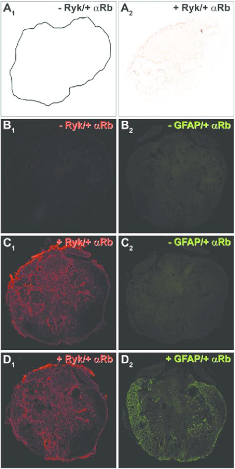 Negative Controls For Simple And Double Immunohistochemistry A 1 A Download Scientific