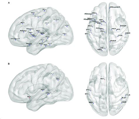 Brain Regions Show Significant Alterations Of Nodal Efficiency In