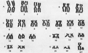 Homologous Chromosomes: Definition, Pairing & Separation | Study.com