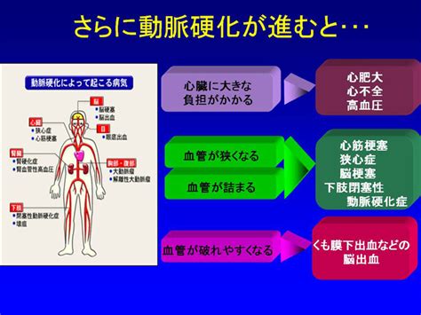 動脈硬化は何でわかる 頸動脈エコー血圧脈波検査 らくわ健康教室 講演録