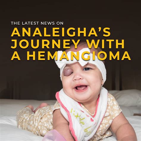 Little Baby Face Foundation | Facial Birth Deformity Corrections