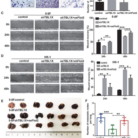 Tbl X Enhances Npc Cell Migration And Invasion A B Transwell