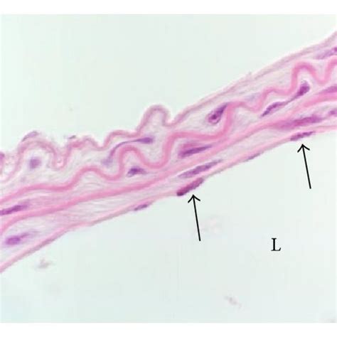 Representative Mouse Carotid Artery Cross Sections With Without Carotid