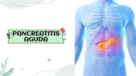 Pancreatitis Aguda Katty Ramirez UDocz