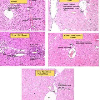 Mouse Liver Histology at 20X of all Groups (labelled). Pv-Portal Vein ...