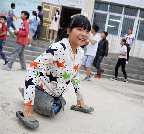 女孩救母失去双腿 爬行12年坚韧求学新闻资讯湖南佳满假肢 您的假肢装配专家！