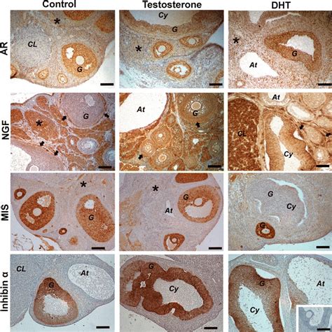 Immunohistochemical Detection Of Androgen Receptor Ar Nerve Growth