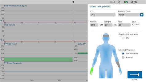 How To Setup Non Invasive Hemodynamic Monitoring Lidco Us Youtube