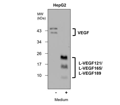 Angiogenesis Antibody Panel IRAP5018 IReal Biotechnology Inc